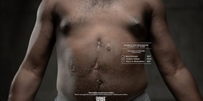 superimposed voter ballots over the bullet scars of a real survivor of gun violence