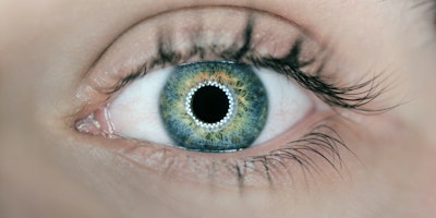A close-up of an eye with lights showing in the retina